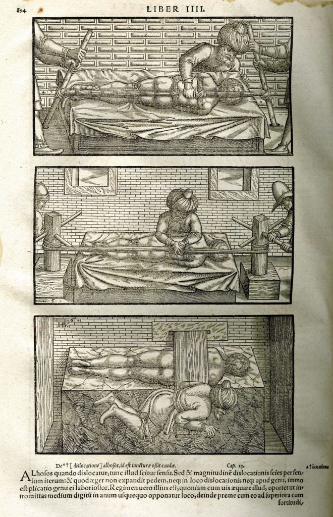 İranlı hekim Avicenna 'nın Tıp Kanunları kitabının 1556 baskısından çizimler.