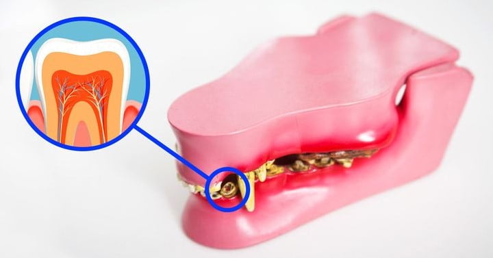 Takma Dişler Tarih Olabilir. Araştırmacılar Kaybedilen Dişleri Yeniden Çıkarmanın Bir Yolunu Buldu.