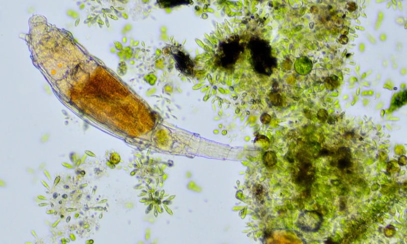 Sibirya'da bulunan mikroskobik canlının 24 bin yıl hayatta kaldığı keşfedildi