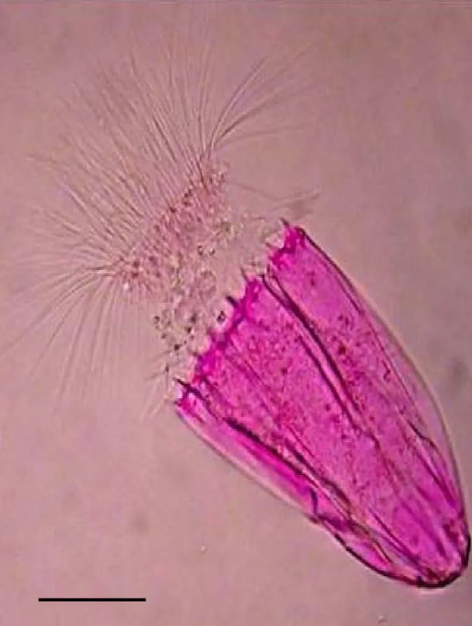 Spinoloricus, yaşamak için oksijene ihtiyaç duymayan küçük ama çok hücreli bir organizma. 