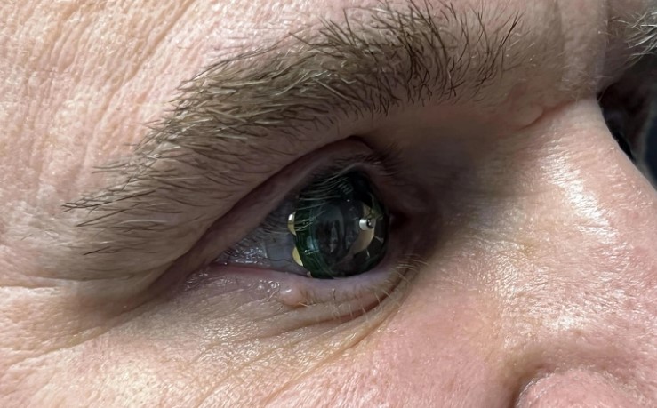 Bu akıllı kontak lensler ile geleceği görebilirsiniz.